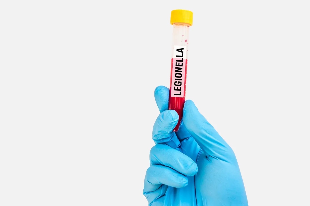Mano guantata tiene provetta con campione per Legionella