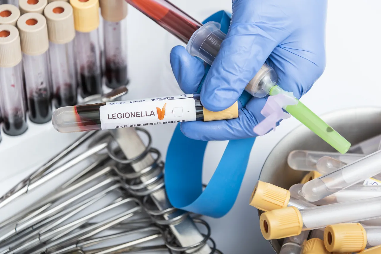 Provette di sangue per test della Legionella in laboratorio